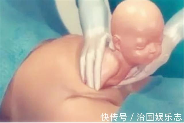 宝妈|九张剖腹产手术全过程图片,那些说生孩子容易的人好好看看