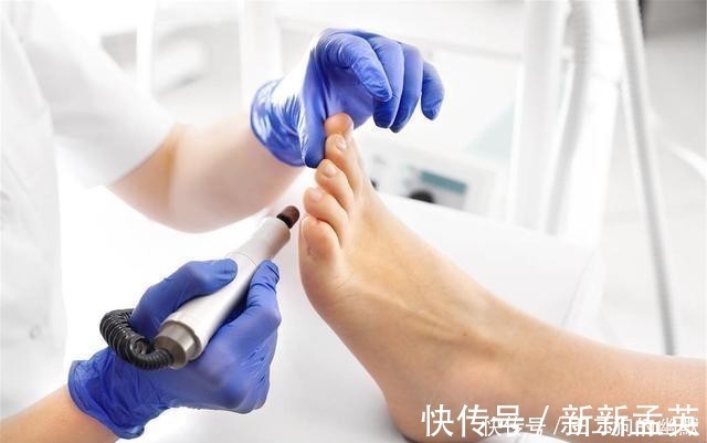 小知识|对半月板损伤后有疑惑?给你科普两个小知识,弥补你的知识空缺