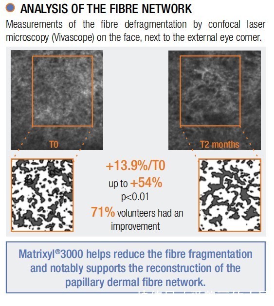 化妆品|为什么玻色因在化妆品原料界越来越受欢迎?
