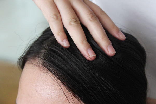 头皮|35岁女子坚持用盐水洗头发,不久后,发生的变化比较令人惊喜