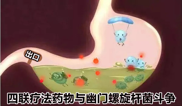 四联疗法双刃剑,不良反应是隐患|大白话说中医第一百六十期| 四联