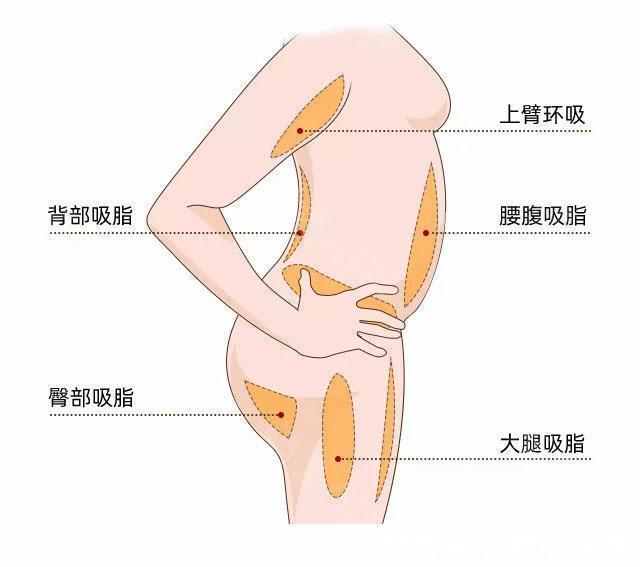 原理 吸脂手术原理是什么?直击腹部吸脂手术全过程