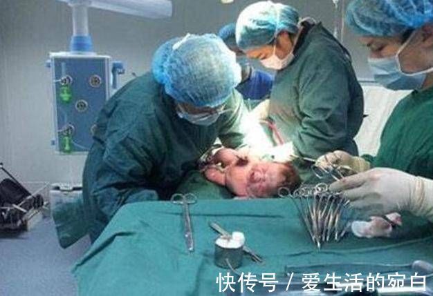 是真的吗|头胎剖腹产,第二胎继续剖,到底有多痛这些有经验的宝妈这样说