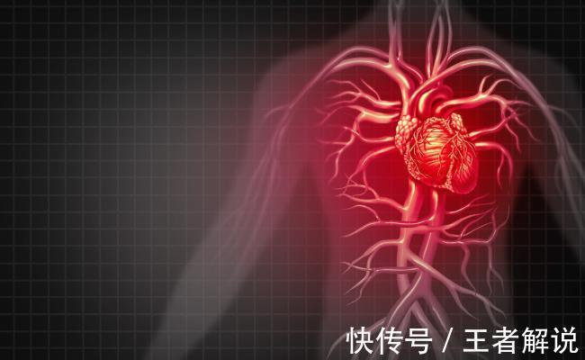 嘌呤|非布司他是降尿酸“利器”,长期吃有副作用吗?医生告诉你实情