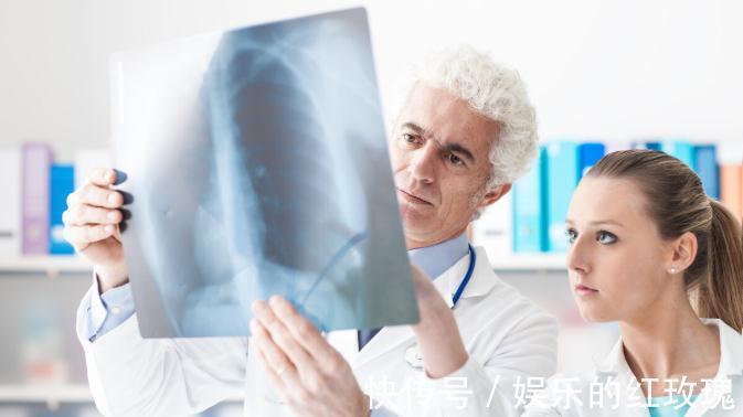 肿瘤科|癌症并没那么可怕，肿瘤科医生规谏，坚持做好5点，就可长期生存