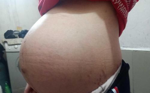 孕妈|胎儿“退房”前,孕妈身体会有这三个信号,预产期只能做参考