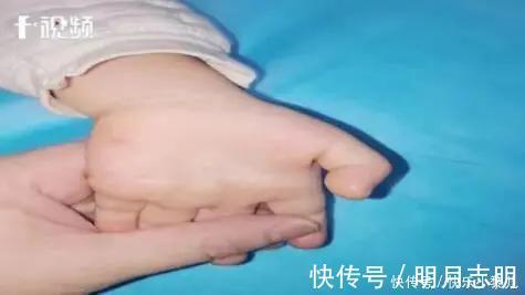 电子产品|3岁女童手指无法屈伸，元凶家家都有，这类“精神鸦片”害娃不浅