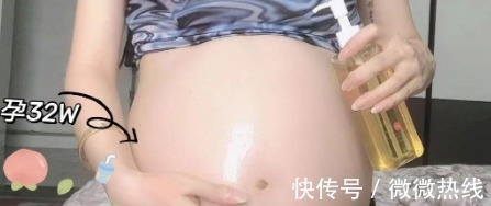精华乳|怀孕后害怕身上长妊娠纹,注意这些要点,让妊娠纹离得远远的!