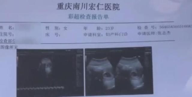 重庆一女子做整容手术，术后2天恶心呕吐，医院