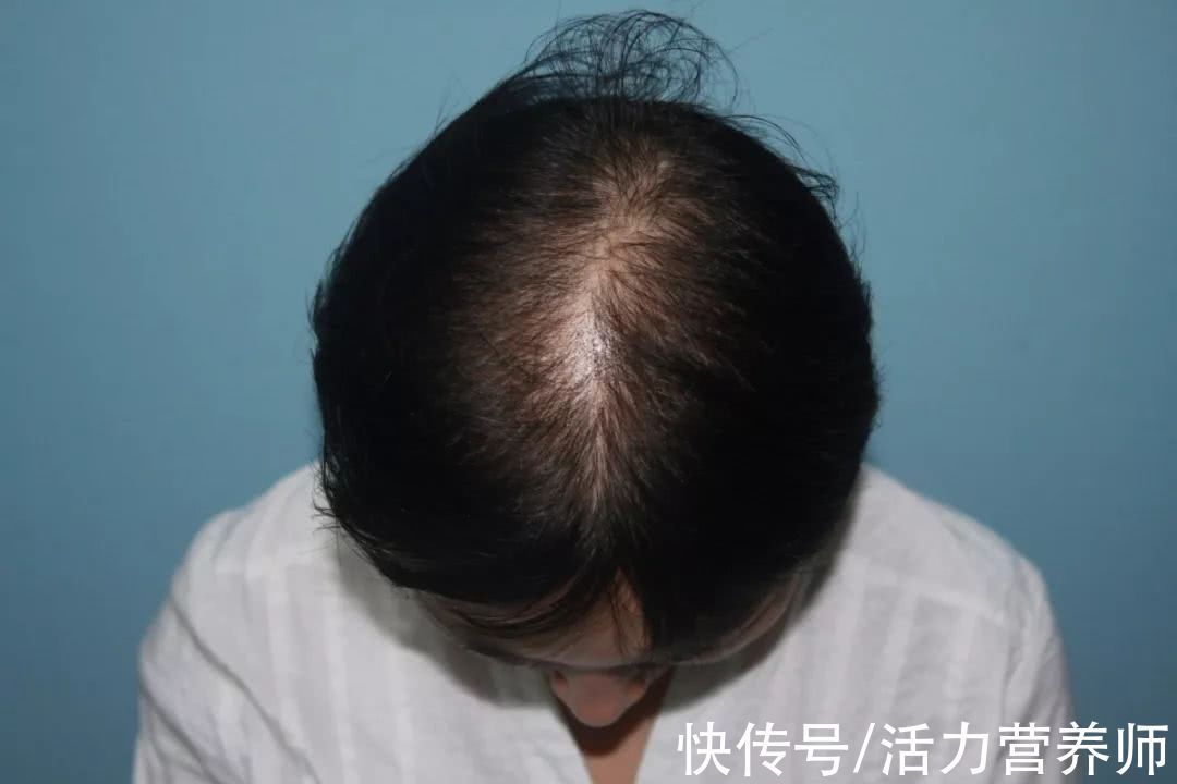 吸收率|补充蛋白质只能吃肉?大错特错,这3种普通食物也是蛋白质高手