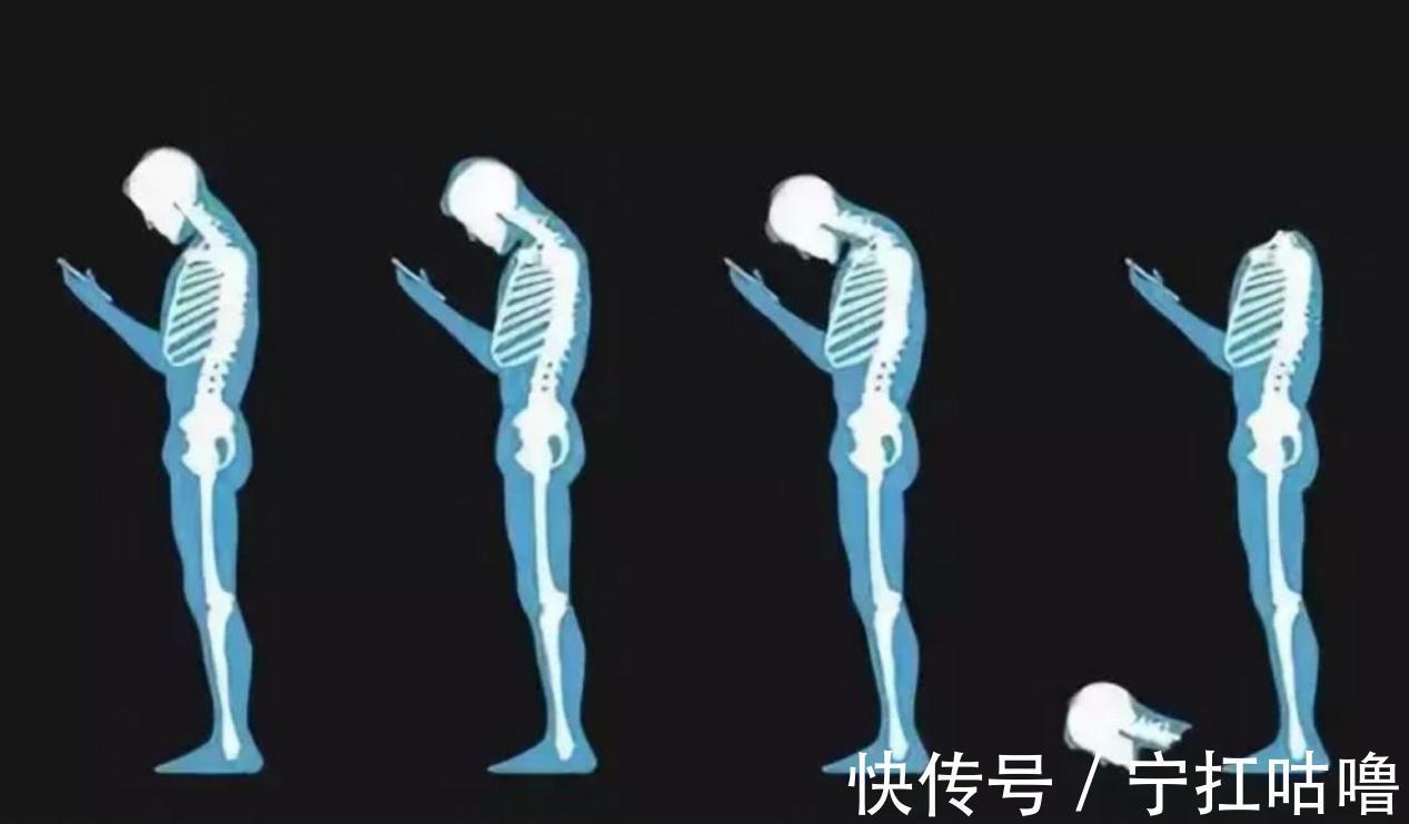 麝香壮骨膏|你的颈椎需要保护吗？颈肩疼痛不要拖，治疗调理越早越好！