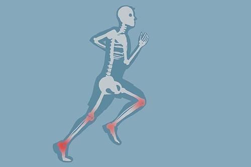 膝盖|坚持每天跑步,反而毁了膝盖?跑步伤膝,究竟是什么地方做错了?