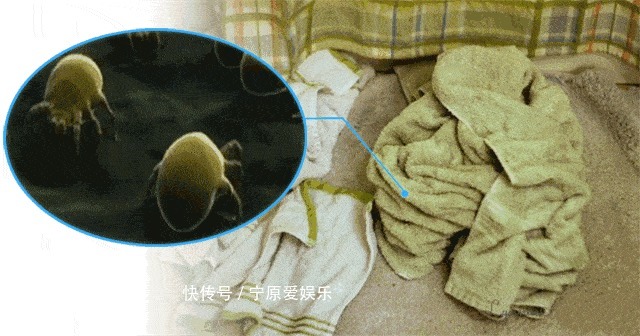 臭味|毛巾酸臭味从何而来别再用“臭毛巾”擦脸了!快来看看毛巾多脏