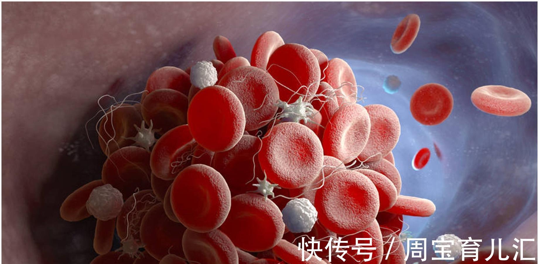 银杏|为什么很多人突然就中风了？不用质疑，大多与这2点有关