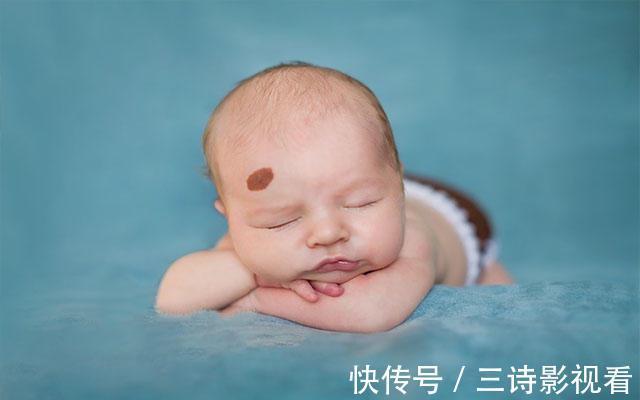 混合色|要想宝宝出生后不长胎记,孕期避免这几件事就OK,你做到了几条