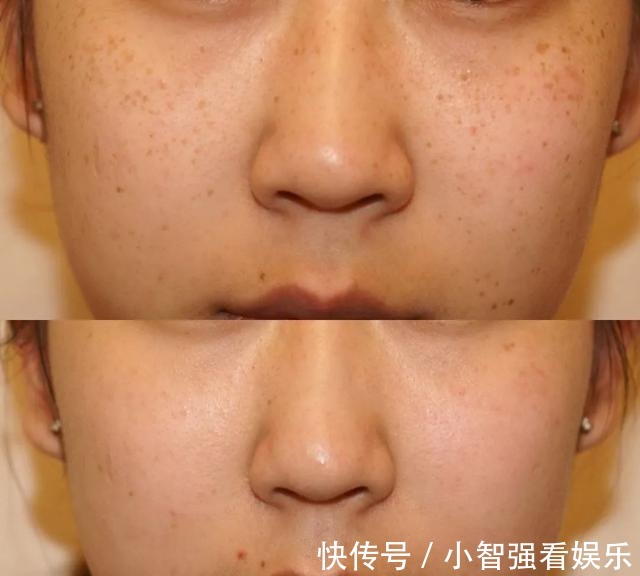 衰老|女性开始衰老的时候,脸部或有这几个表现,快来了解一下吧