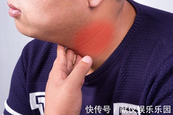 院士|甲状腺结节不能吃白萝卜?80岁院士:想要结节消失,3种食物少碰