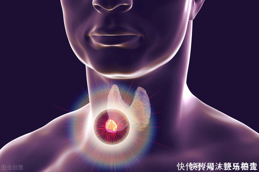 甲状腺结节|甲状腺结节的源头是什么?医生:饮食上注意一点,或可以解决问题