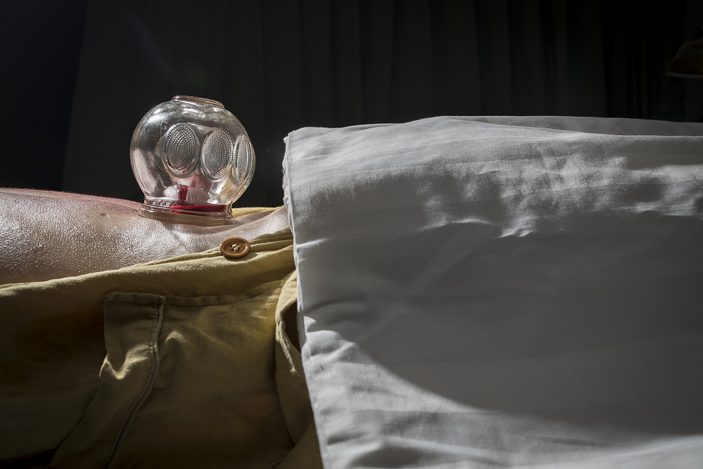 放血疗法|刺血不传之秘!20个最有用的针刺处方和25个放血疗法!赶紧收藏