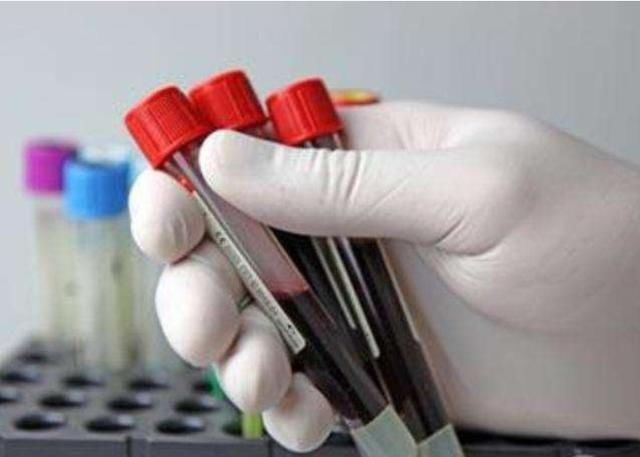 过完产褥期42天，不要忘了这六项检查，关系宝妈身体恢复别忽视