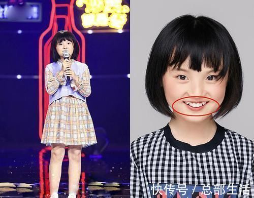 牙科医生|15岁男孩长出“尖牙”,妈妈亲手摸过后吐槽:养了个“吸血鬼”