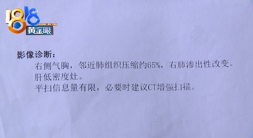 扭伤|针灸后查出来“气胸”，怀疑针灸扎到肺