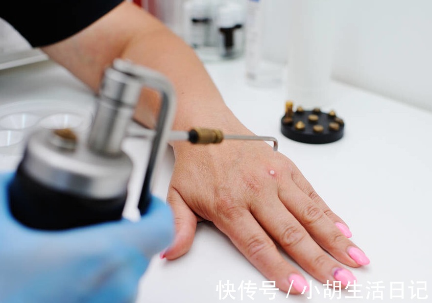 HPV感染|女童喉咙疼痛长“菜花”,一家三口都查出HPV感染,医生:这坏习惯很多人都有