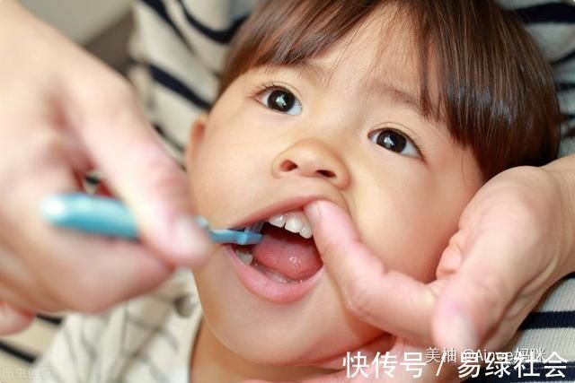 乳牙|孩子乳牙整齐漂亮,换牙后却越来越“歪”可能是这几点没做好