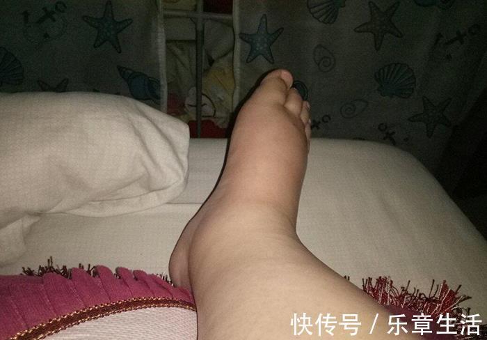 顺产|“生剖”是什么体验？抗麻体质剖腹产生双胞胎，痛得直哆嗦