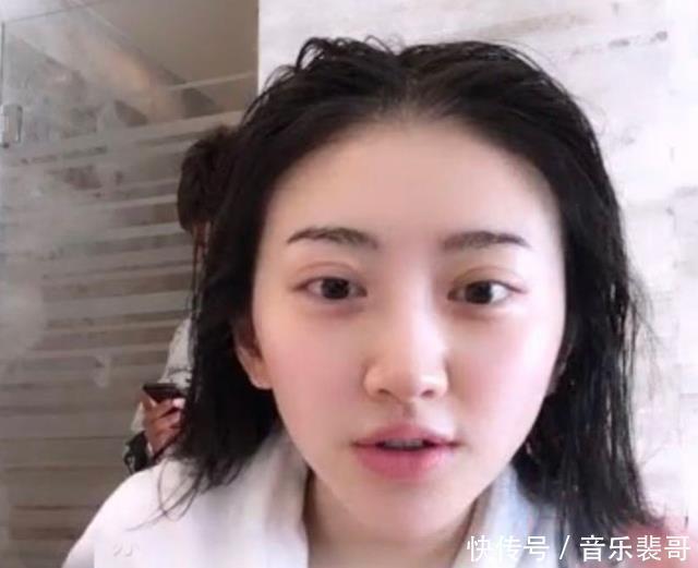 不老女神|还有多少女明星为了变美，而去饮鸩止渴打玻尿酸