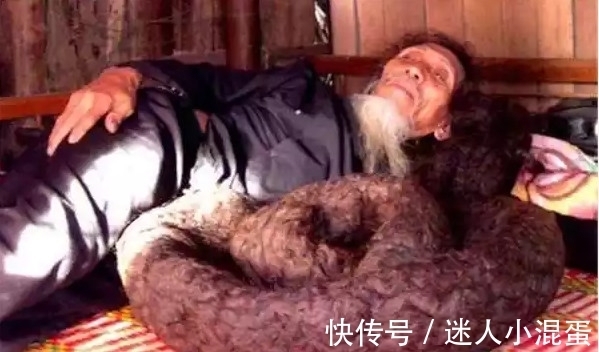 老汉|10岁的时候因为生了一场病,这个老汉72年不理发,不洗头!