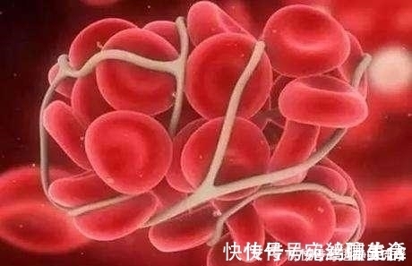 症状|血液粘稠的人，晨起后往往会有3个症状，如果你有要多喝1种水