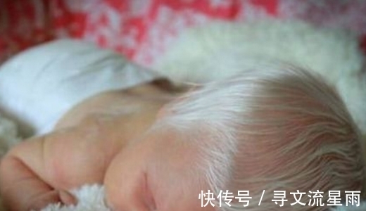 dn孕妇生下满头白发的宝宝,检查结果让人意外