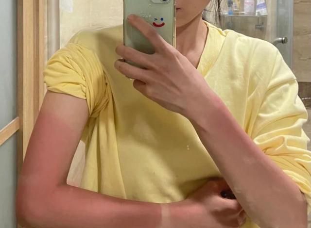 夏日|女生夏日护肤,比防晒更重要的是:晒后修复!这才是“变黑”原因