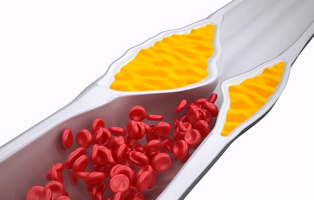 喝水多与喝水少,区别能有多大?医生提醒:喝水也要讲科学