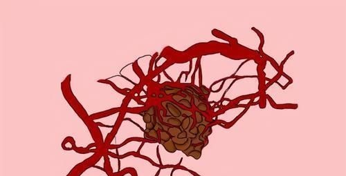 医生|癌症多长时间不复发,算是治愈了?医生给出3个标准,你达标没?