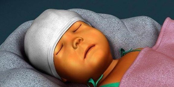 妙招|消除新生儿“黄疸”的3个“小妙招”，新手宝妈赶快行动起来吧！