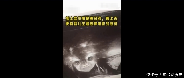 却说|毛骨悚然！孕妇做B超被吓坏，孩子突然睁眼怪笑！医生却说……