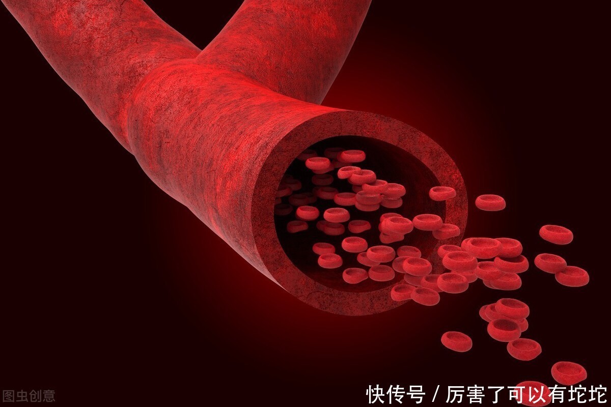 血脂|甘油三酯“害怕”一物,不是洋葱,水里放一勺,血脂乖乖下降