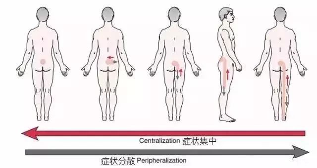 腰间盘突出，坐立难安！这样坚持十天，腰再也不“突出”！