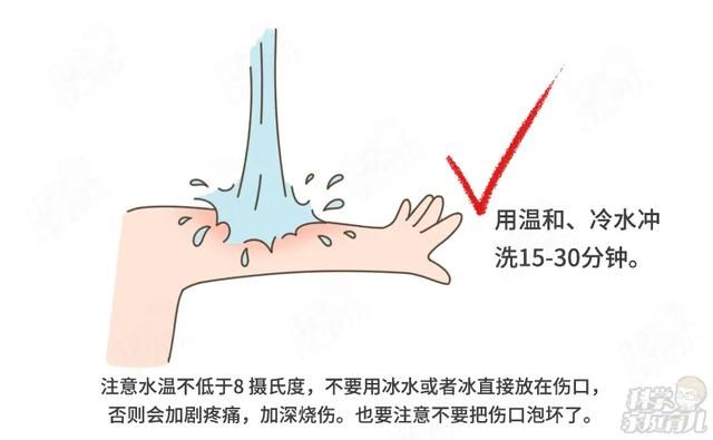 自愈能力|偏方治烫伤，6月娃不幸离世！孩子烫伤后，牢记5个字，能救命