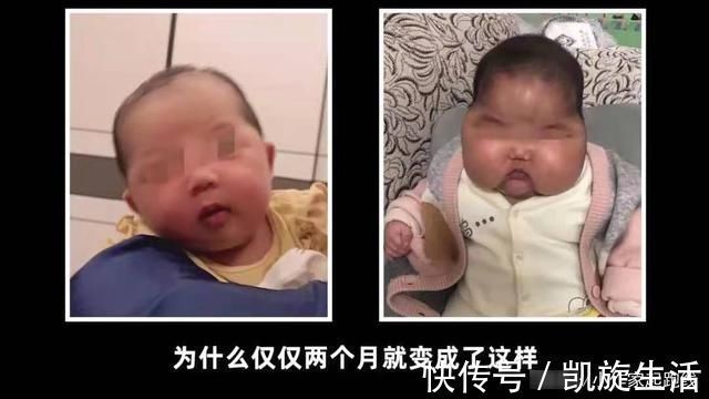 大头娃娃|宝宝霜致一婴儿变成“大头娃娃”,只因内含激素,生产商拒不承认