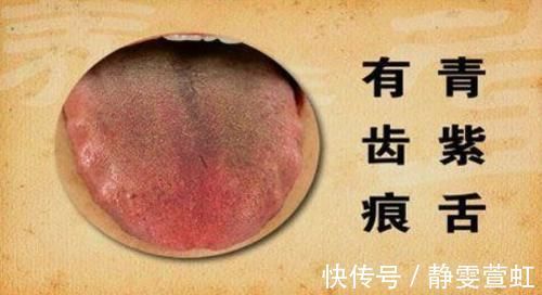 道家|手上的这颗“救心丸” ，此处通了，说明心脏血管也通了！