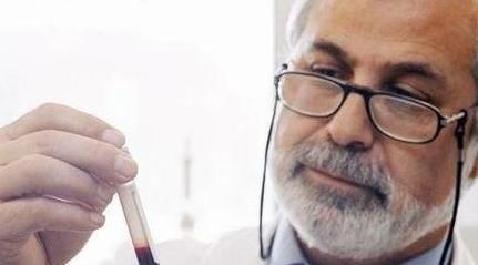 前列腺肿大|男性40岁后,务必要做4项身体检查,或能为健康“加分”!