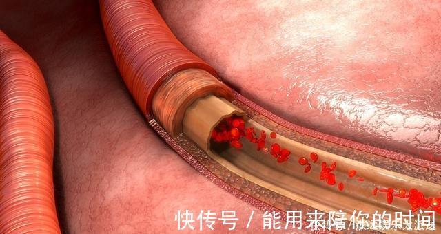 医生|高血压就怕缺钾，吃什么能补钾医生给您列出清单，别不舍得吃