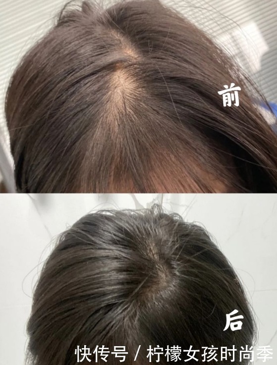 护发素|4款公认直呼好用的防脱洗发水，难怪别人发量惊人，看看你用过没