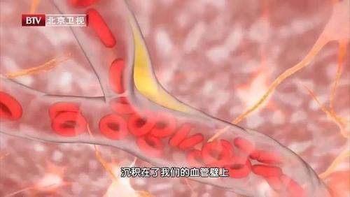 豆制品|大豆是调血脂“高手”，但吃错血脂可能更高！想营养翻倍这样搭配