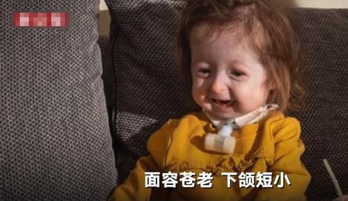 全球首例！2岁女童却有80岁的脸，网友：希望能像本杰明巴顿一样