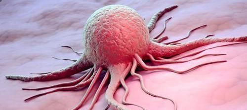 强身健体|癌症治疗后没一年又复发这些原因是罪魁祸首，患者要注意