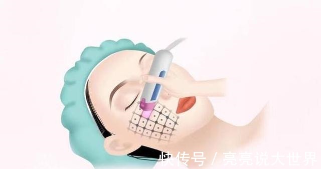 皮秒 医美种草盘点5个最值得做的医美项目!